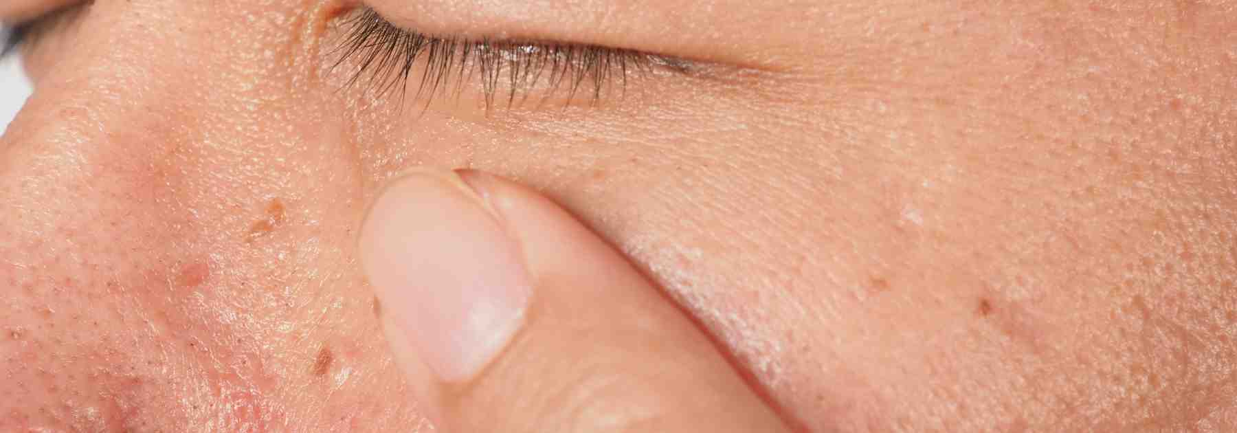 Private Cryotherapy in Manchester