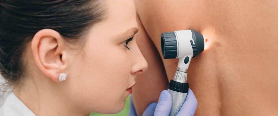 Mole removal near me in Manchester